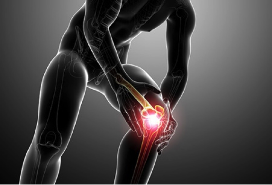 Do you suffer knee pain? Rehabbing Patella tendonitis